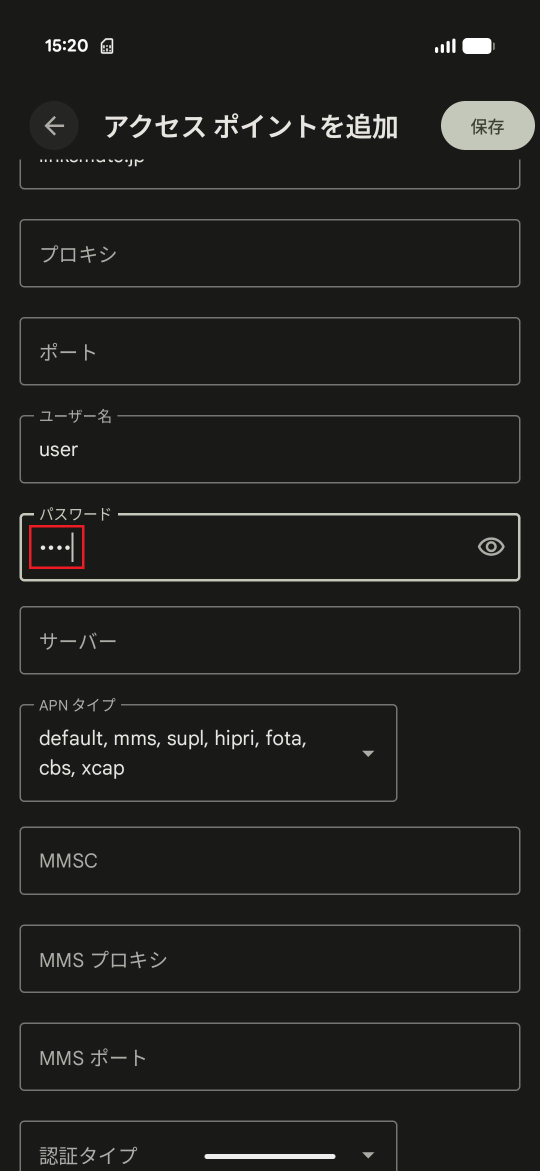 STEP15の設定画面